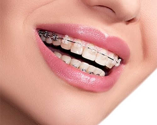 orthodontics_small