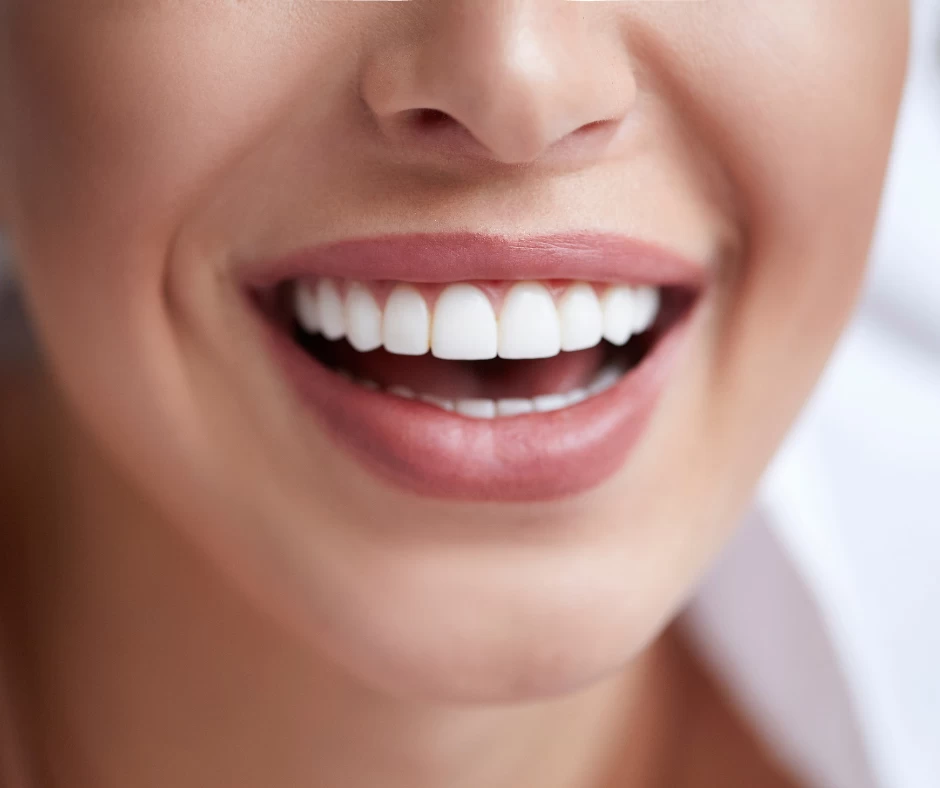 Root Canal Therapy