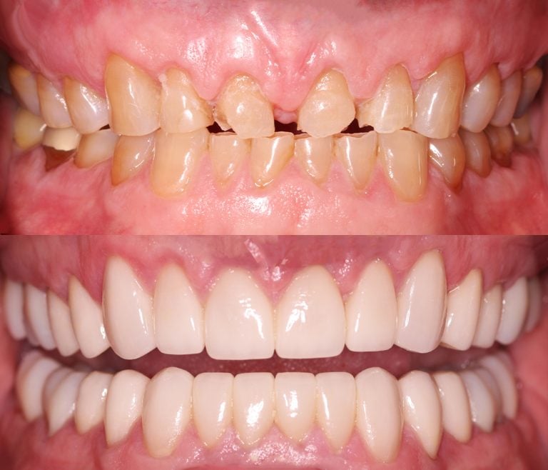 Restored Confidence after treatment